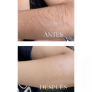 Silkvia – Depilación IPL Profesional desde Casa