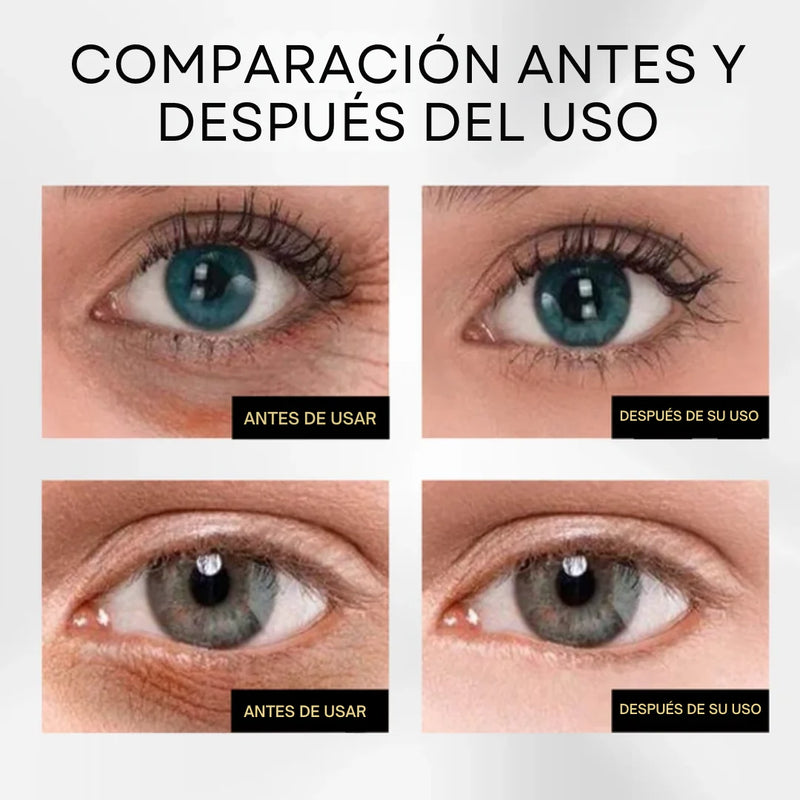 OUHOE™ SERUM QUITA OJERAS - [PROMOCIÓN DISPONIBLE SOLO HOY]