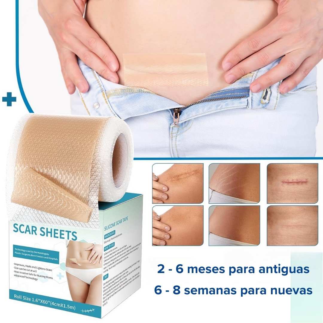 Siliscar CINTA PARA CICATRICES QUELOIDES - [PROMOCIÓN DISPONIBLE SOLO HOY]