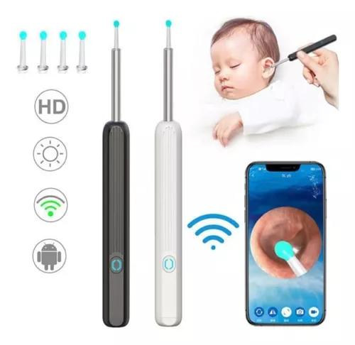 Otoscopio Digital WiFi – Explora Con Claridad Y Seguridad