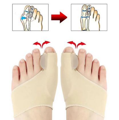 ComfortToe Corrector (1 Par) de Juanetes Ortopedicos - [PROMOCIÓN DISPONIBLE SOLO HOY]