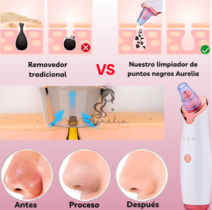 Pure Skin Limpiador de Puntos Negros + Green Mask Stick Mascarilla Té Verde GRATIS - [PROMOCIÓN DISPONIBLE SOLO HOY]